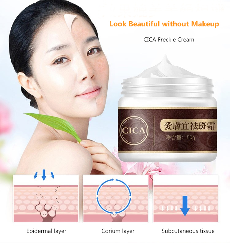 cica freckle