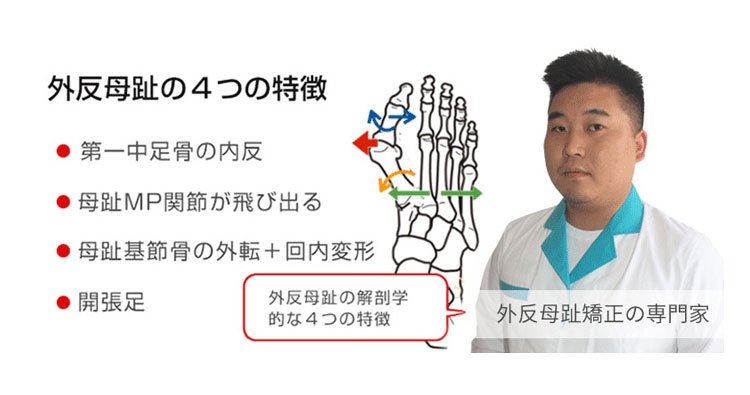 日本足科矯形醫師設計 完美足弓強力支撐矯正鞋 Tikoshop