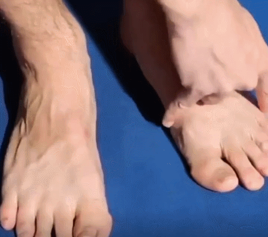 足跟舒筋活絡腳痛膏 27 4bc1bbbe61bf8de59a5be384cfcdb7c1 足跟舒筋活絡腳痛膏