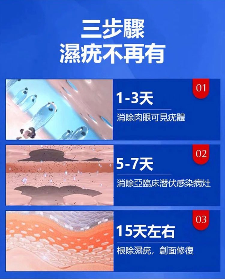 雲南本草克疣膏 22 51a0b4a2fe40bfb94b130d9485368490 雲南本草克疣膏