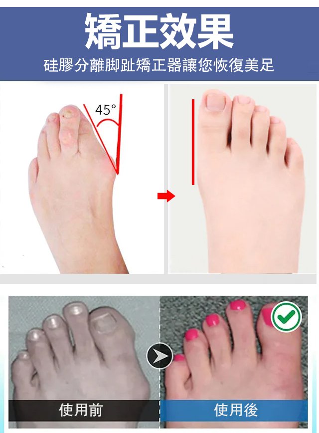 足跟舒筋活絡腳痛膏 25 53504f46f89806c701f4ec60b18d9968 足跟舒筋活絡腳痛膏