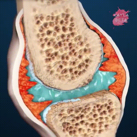 足跟舒筋活絡腳痛膏 18 a189d91d0d44c96c84985186ce57c7e8 足跟舒筋活絡腳痛膏