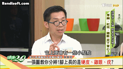 雲南本草克疣膏 10 a1ed5b11a8ee4d8061819cfd6813c8fa 雲南本草克疣膏