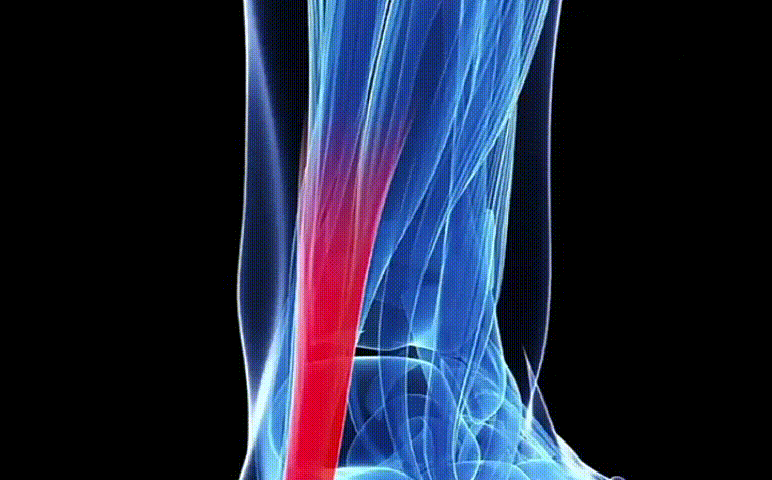 足跟舒筋活絡腳痛膏 11 ff5465ee041a5715d929bafb388f1084 足跟舒筋活絡腳痛膏